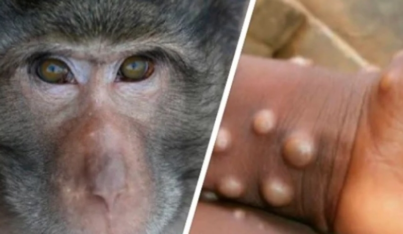 ВОЗ сообщила о 646 случаях оспы обезьян в мире в мае